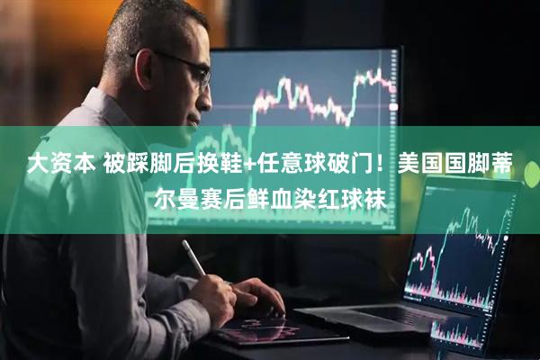 大资本 被踩脚后换鞋+任意球破门！美国国脚蒂尔曼赛后鲜血染红球袜